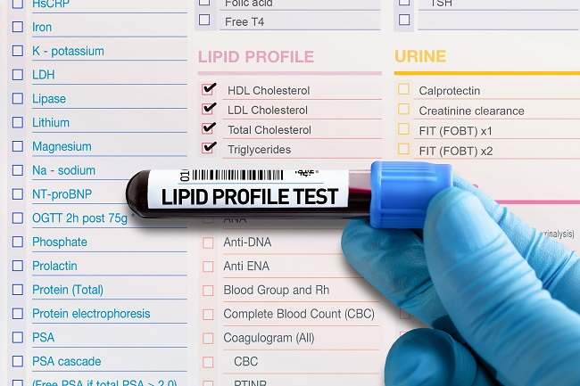 Pentingnya Pemeriksaan Profil Lipid/ Profil Lemak